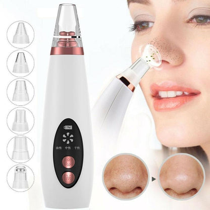 Professional Blackhead Vacuum Cleaner,Deep Pore Suction Remover Tool